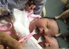 弱精男士多年无子 最终赴美试管成功